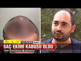 Sac Ektirmeye Gitti Basina Gelmeyen Kalmadi Youtube