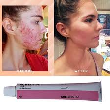 Türkiye abdi i̇brahim i̇laç şirketini mi arıyorsunuz? Acnelyse Cream Tretinoin 0 1 20 G 1 Tube Abdi Ibrahim Cryptomedicine