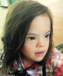 Mum shocked after doctors suggest she terminate her baby with Down syndrome 