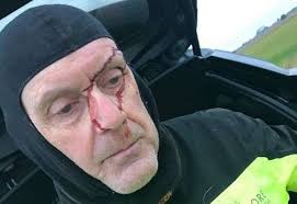 Gorefield grandfather suffers gash to head in unprovoked attack as he was  cycling now family are appealing for help to catch his attackers