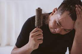 Tips untuk lebatkan rambut dan mengatasi rambut gugur. 6 Cara Mengatasi Rambut Rontok Pada Pria