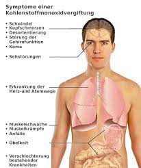 Ist dies nicht mehr der fall, dann wird eine intubation vorgenommen in dem ein schlauch direkt in die luftröhre gelegt und darüber der sauerstoff appliziert wird. Kohlenmonoxid Vergiftung Ursachen Und Symptome