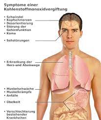 Unsichtbar, geruchlos, nicht zu schmecken, nicht reizend: Kohlenmonoxid Vergiftung Ursachen Und Symptome