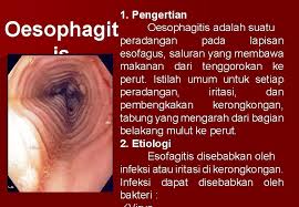 Ruhul qudus adalah nama lain dari malaikat jibril sumber referensi nama lain malaikat: Patofisologi Sistem Digestif Pada Penyakit Esofagus Lambung Dan