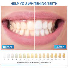 Amazon Com Teeth Whitening Kit Baifros Led Light 35 Carbamide Peroxide 4 5ml Gel Syringes Tray And Case Beauty Personal Care
