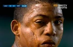 Juvenil de River Ecuador tuvo fractura de pómulo en choque contra Liga de  Loja