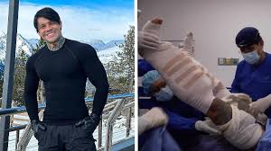 Kolumbianischer Instagram-Star: 160.000 Euro für die schmerzhafteste  Schönheits-OP der Welt