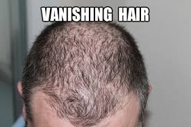 Neither creatine nor bcaas or any other aminos cause hair loss but actually help in the creation itself (not growth) of the hair follicle! Bcaa Health Risks Side Effects Of Bcaas Are Bcaas Safe