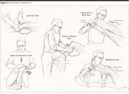 Image result for Lachman Test