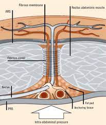 Abdominal Wall Pain A Common Clinical Problem Mayo Clinic Proceedings