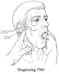 When we do it the finger and thumb position is reversed. How To Pop Your Jaw Back In Place Quora