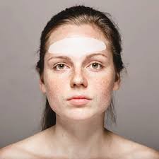 Eliminate forehead and frown lines naturally