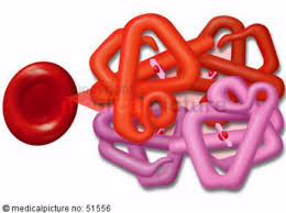 Your healthcare provider can check on the size, shape, and health diseases of the red blood cells include many types of anemia. Red Blood Cell With Hemoglobin Molecule Doccheck