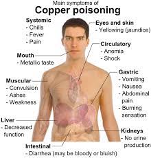Main Symptoms Of Copper Poisoning Copper Toxicity Symptoms Copper