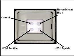 Multispot Hiv 1 Hiv 2 Rapid Test Download Scientific Diagram