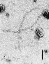 Image result for Grapevine leafroll virus