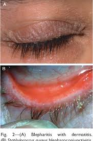 Image result for Blepharis bainesii