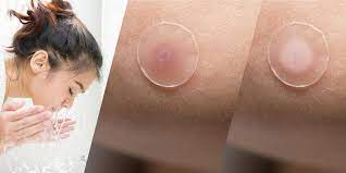 We did not find results for: Mighty Patch Review 2020 These Pimple Patches Really Work To Get Rid Of Whiteheads And Acne Overnight