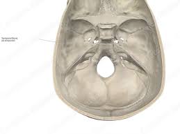 Image result for Temporal Bone