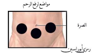 فوائد الحجامة لالتهابات الرحم مدينة الرياض