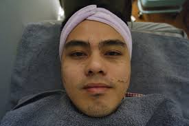 Hannan medispa now has 53 branches throughout malaysia, including the head office in the kuala. Rawatan Carbon Peel Di Hannan Medispa Damansara