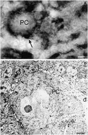 These are the best vacuums for pet hair which consumers have praised in their reviews. Localization Of Cannabinoid Receptors Using Immunoperoxidase Methods Springerlink