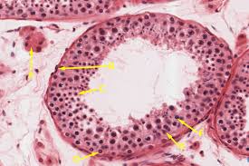 Abundant leydig cells remain in the interstitium. Male Reproductive System Histology