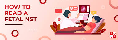 Image result for Non-Stress Test