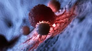 Your guide to mesothelioma, including what it is, the different types and stages it has, the treatments available and how to cope with your diagnosis. Dendritic Cell Therapy For Mesothelioma Can It Boost Other Treatments
