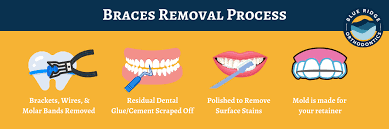 18 Months With Braces- So Worth It! : R/Braces