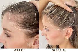 BIOTIN Saç Uzatma PUMP-Serum