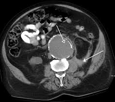 Medical Imaging Wikipedia