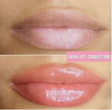 Dark Lip Correction Vancouver Lip Blush Vancouver In 2021 Lip Color Tattoo Dark Lips Lips