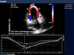 Eingereicht von markus brudniak zur erlangung des akademischen grades doktor der gesamten heilkunde (dr. Kardiologie Dr Med Jurgen Schneider Facharzt Fur Innere Medizin Kardiologie Und Sportmedizin