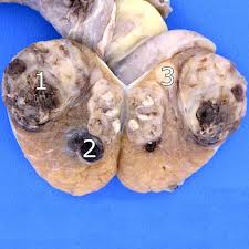 Pin On Medical