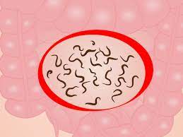 Ce sont les démangeaisons anales provoquées. Vers Intestinaux 5 Vermifuges Naturels Pour Les Humains