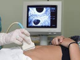 A full bladder helps to push the womb upwards. Dating Scans Babycenter Australia