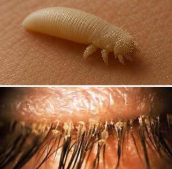 Curiosidades - Ahora mismo, mientras lees esto, en tu cara viven &aacute;caros  microsc&oacute;picos de ocho patas llamados Demodex, miden 0,3 mil&iacute;metros y no los  ves, no los sientes, pero est&aacute;n ah&iacute;, en
