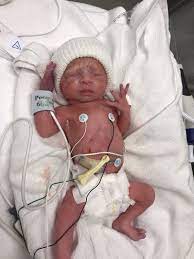 Baby Chloe 32 Weeks And 1 Day April 2019 Babies Forums What To Expect Page 2