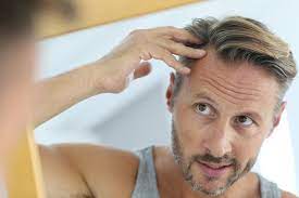 Causes, treatment & prevention tips. Diabetes And Hair Loss Diabetes Self Management