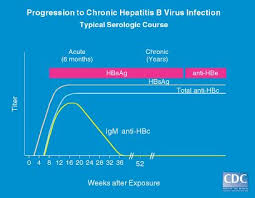 Interpreting Hepatitis B Serology In 5 Easy Steps Epomedicine