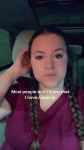 Kiersten Jeter Shares Her Alopecia Journey