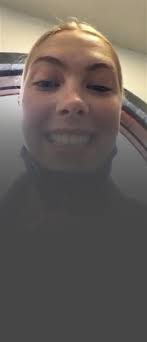 Affordable Porcelain Veneers near me