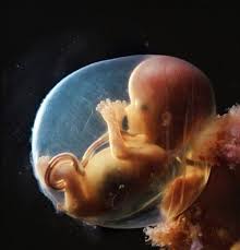 A Baby Born In The Caul Is A Rare Event Vicki Hobbs
