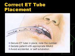 Nellcor adult/pediatric colorimetric co2 detectors are an economical, yet invaluable airway management tool. Airway Management Objectives Identify Indications For Intubation And