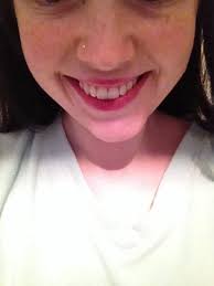 Why Is My Jaw So Crooked Photo