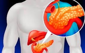 Pancreatite O Que E Dr Valdemir Ferreira