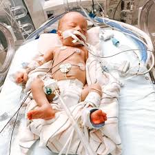 Light for levi and lainey what happened. Light For Levi And Lainey Home Facebook