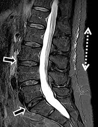 How to use backbone in a sentence. When An Incidental Mri Finding Becomes A Clinical Issue Springerlink