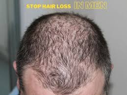 Brushing hair too frequently can injure hair and increase hair loss. 9 Foolproof Ways To Stop Hair Loss In Men Inscmagazine